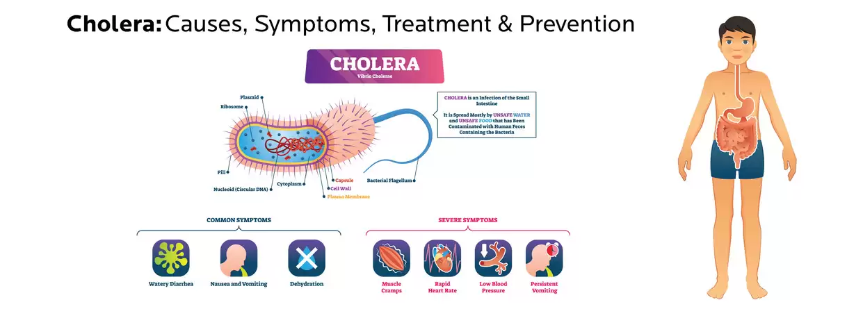 All You Need to Know About Cholera